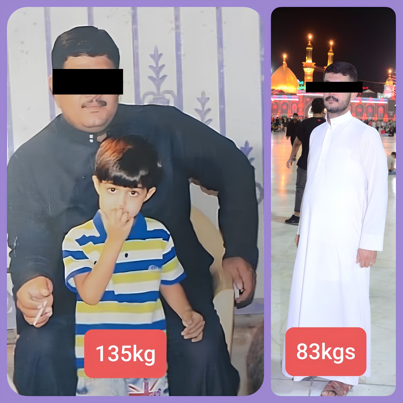 Bariatric surgery patient transformation 1 of 6